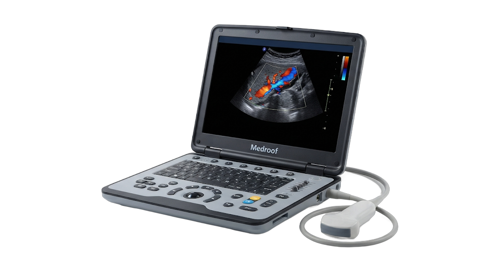 Portable Ultrasound Scanner (Color Doppler)